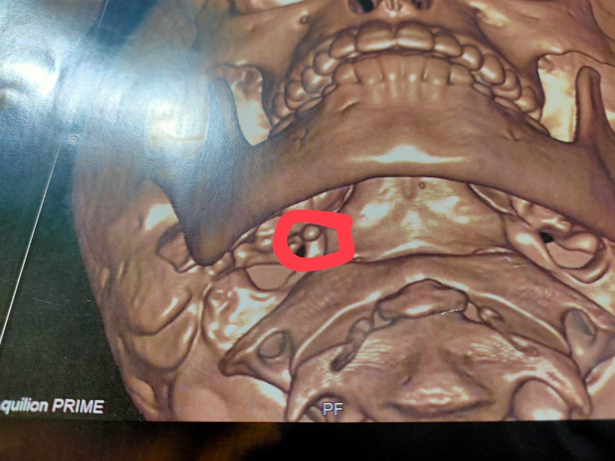 صورة توضح حالة الطفل