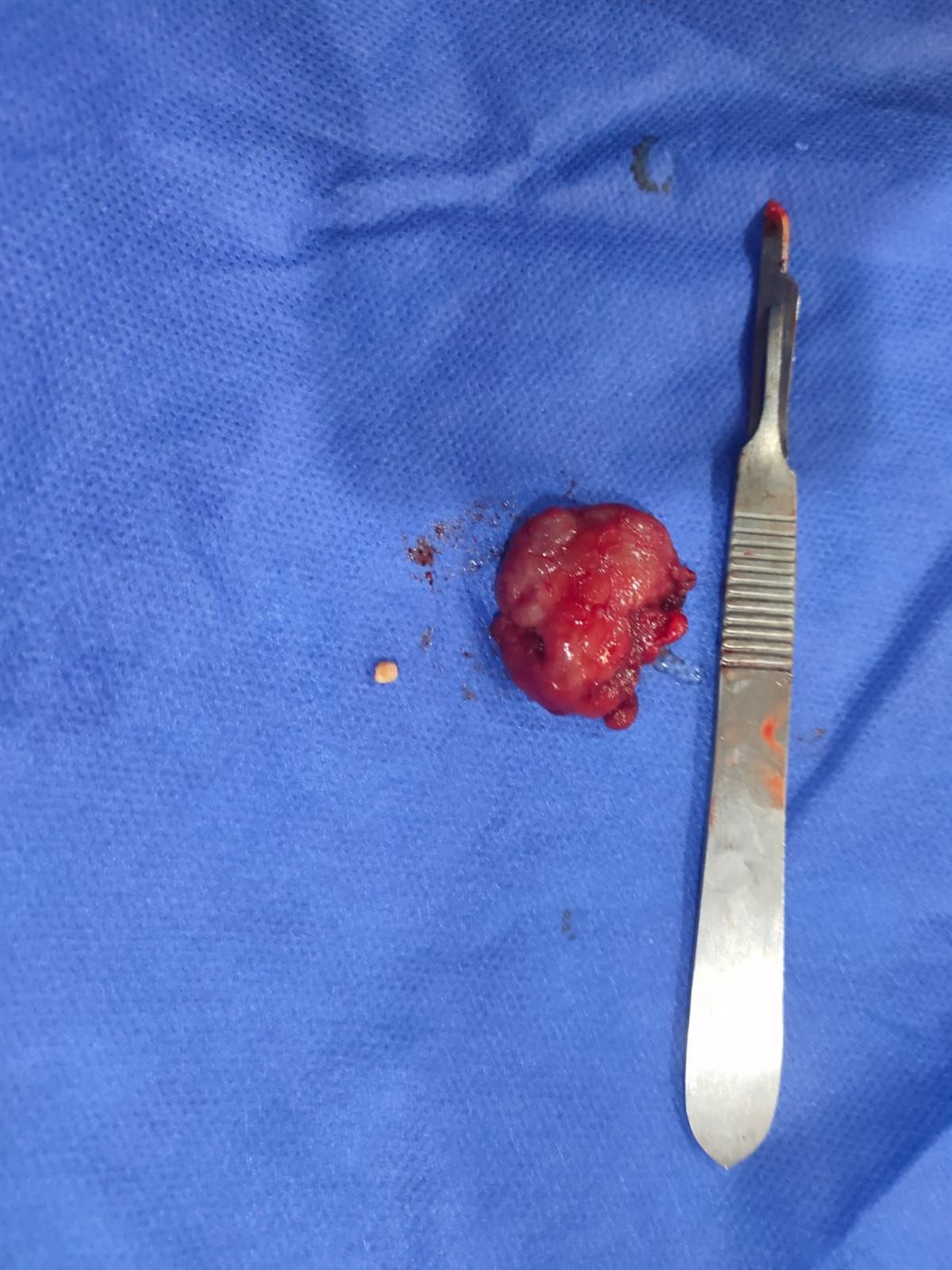 صورة توضح حالة الطفل