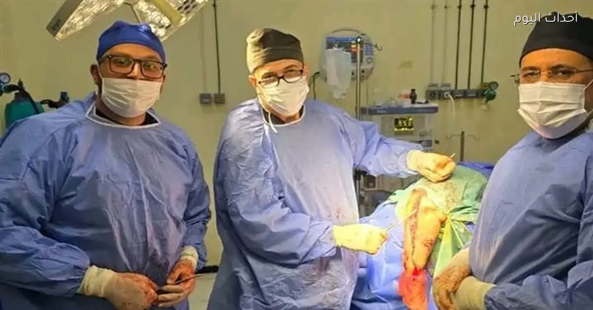 أول عملية تركيب مفصل صناعي بمستشفى بلقاس العام تنجح