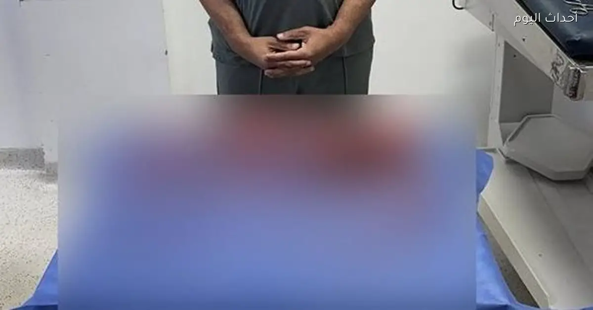 فريق طبي في مستشفى جامعة القاهرة يشيل 100 ورم ليفي من رحم بنت شابة