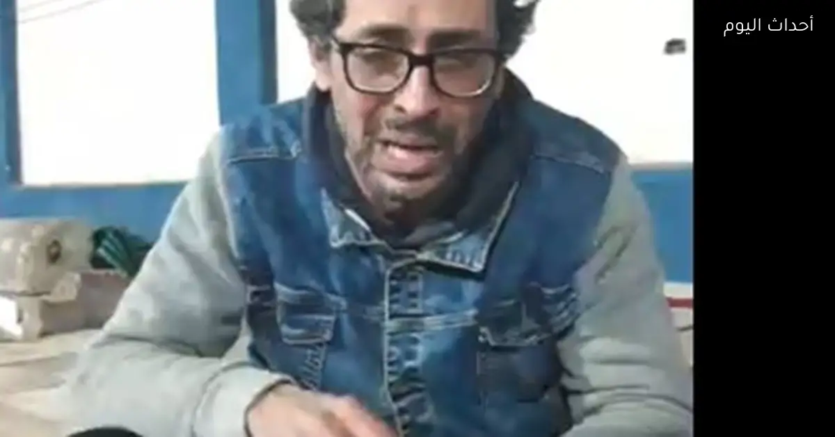 حالة نيلي بعد جراحة القلب: نقص أكسجين بالمخ ونراقبها عن كثب