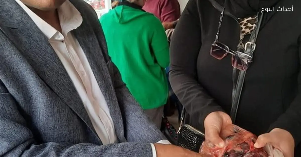 ضبط 144 محضرا لسلع غذائية فاسدة في السويس