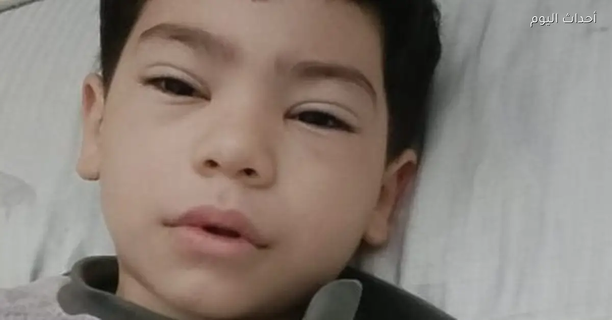 طفل من باسوس في القليوبية يخرج من العمليات بعد جراحة 12 ساعة لإنقاذ قدمه