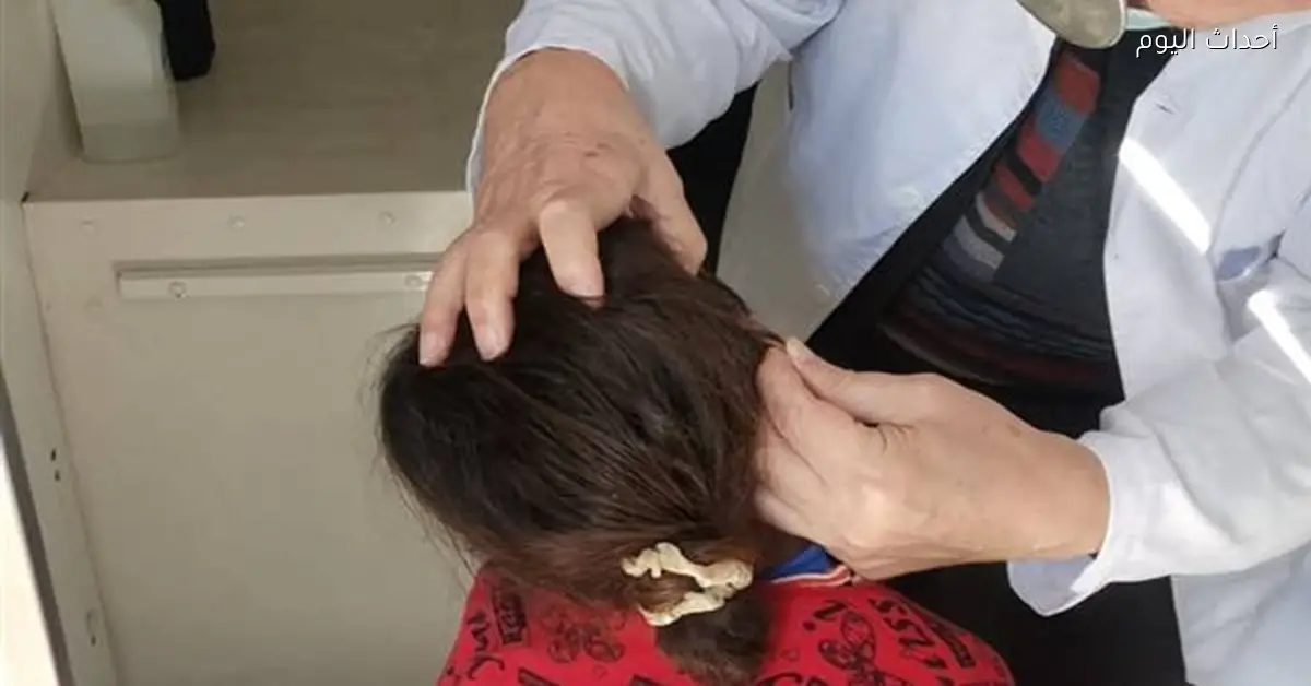 قافلة طبية مجانية للرمد غدا في حي الأربعين بالسويس