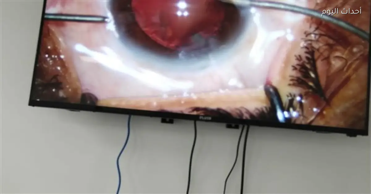 مستشفى نجع حمادي ينفذ 26 عملية جراحية في يوم واحد